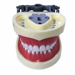 TIPODONTO TIPO NISSI PLATINA METALICA