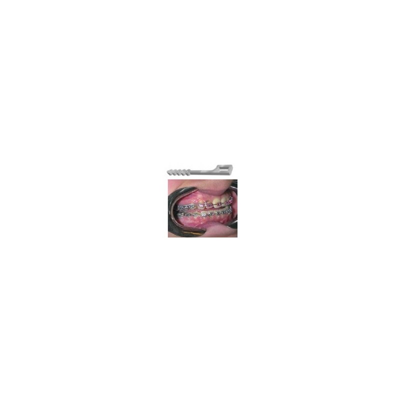 TIE BACK PARA TECNICA STEP O MBT C/10